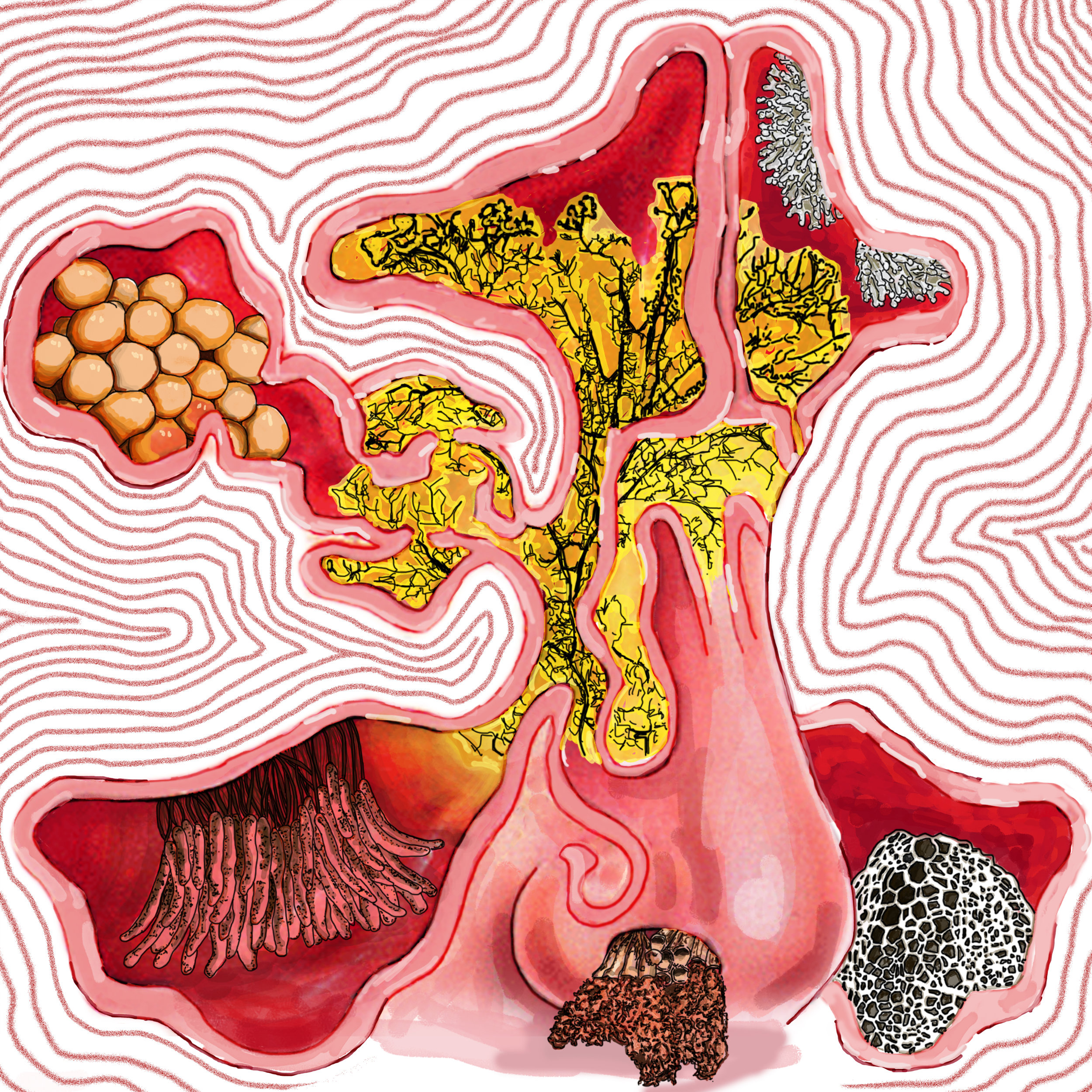 Fungi Growing in sinus (Digital Illustration)